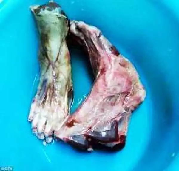 Restaurant accused of serving human feet after graphic image of rotting flesh emerges